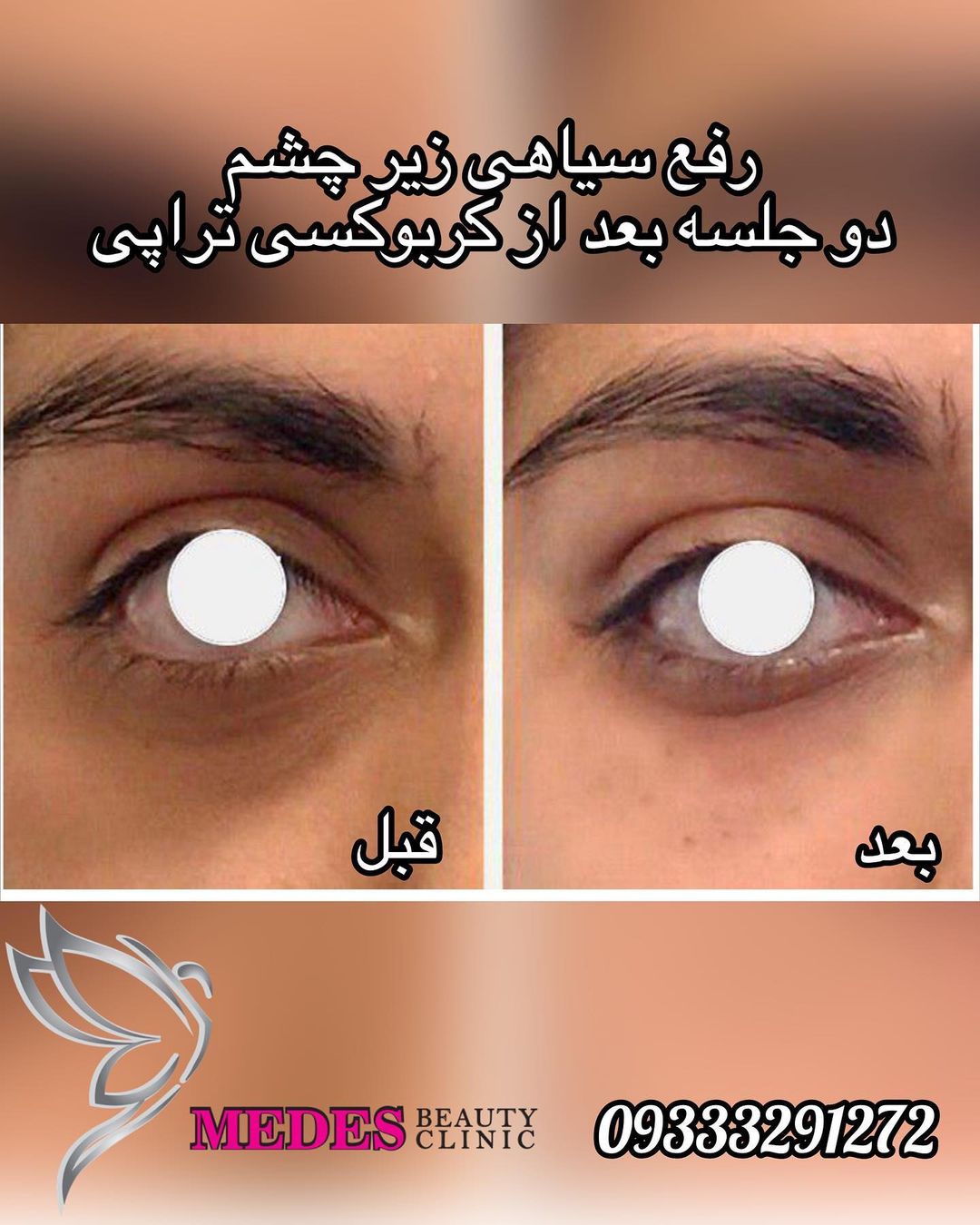 گالری کربوکسی تراپی